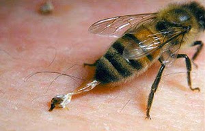Photo of كيف تعالج لسعات النحل معلومات قد تنقذ الارواح